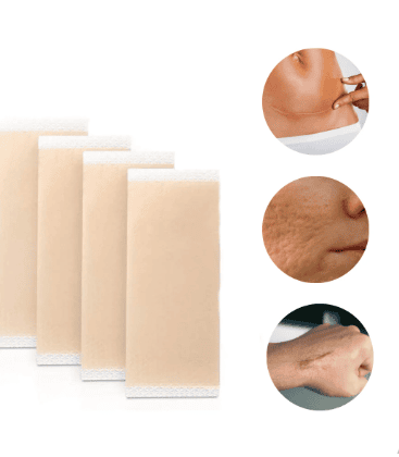 Silicone Scar Sheets