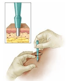 Skin Biopsy Punch Set