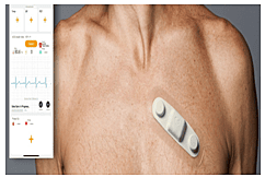 Smart ECG Patch (Wearable)