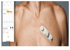 Smart ECG Patch (Wearable)