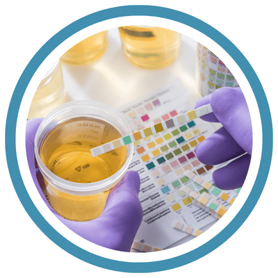 URINE ROUTINE & MICROSCOPY URINE ROUTINE & MICROSCOPY