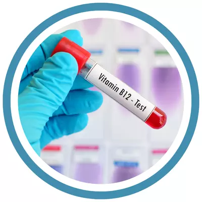 VITAMIN B12 VITAMIN B12