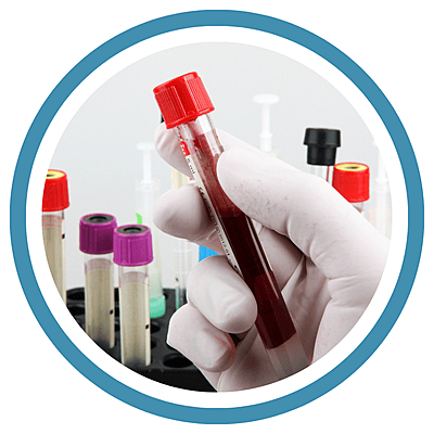 BLOOD CULTURE - BACTEC PLUS