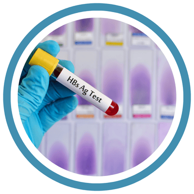 Hepatitis B Surface Antigen Test