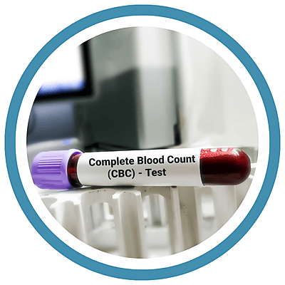 CBC (COMPLETE BLOOD COUNT)