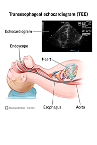 Transesophageal Echocardiography (TEE) Machine