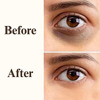 Harsha Naturals - Under Eye Glow Gel