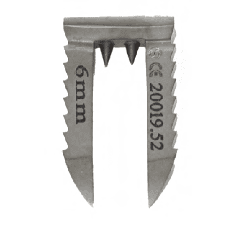 Bone Liagemnt Staple - Titanium