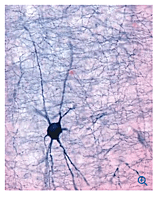 Leica VT1000 S Vibrating blade microtome