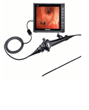 Video Bronchoscopy System