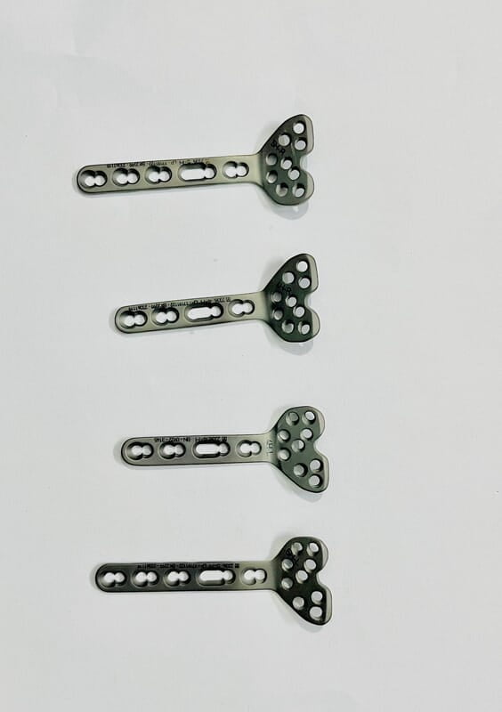 VOLAR COLUMN DISTAL RADIUS PLATE