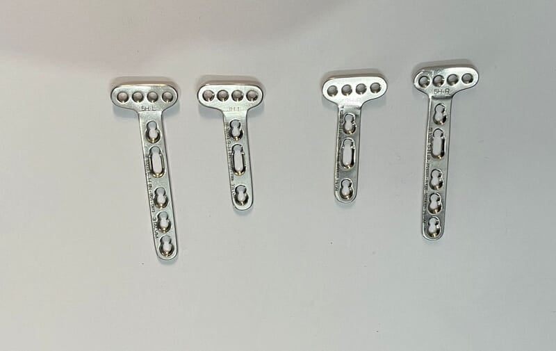 PRIMA LIFT DISTAL RADIUS VOLAR PLATE EXTRA ARTICULAR - 4 HEAD