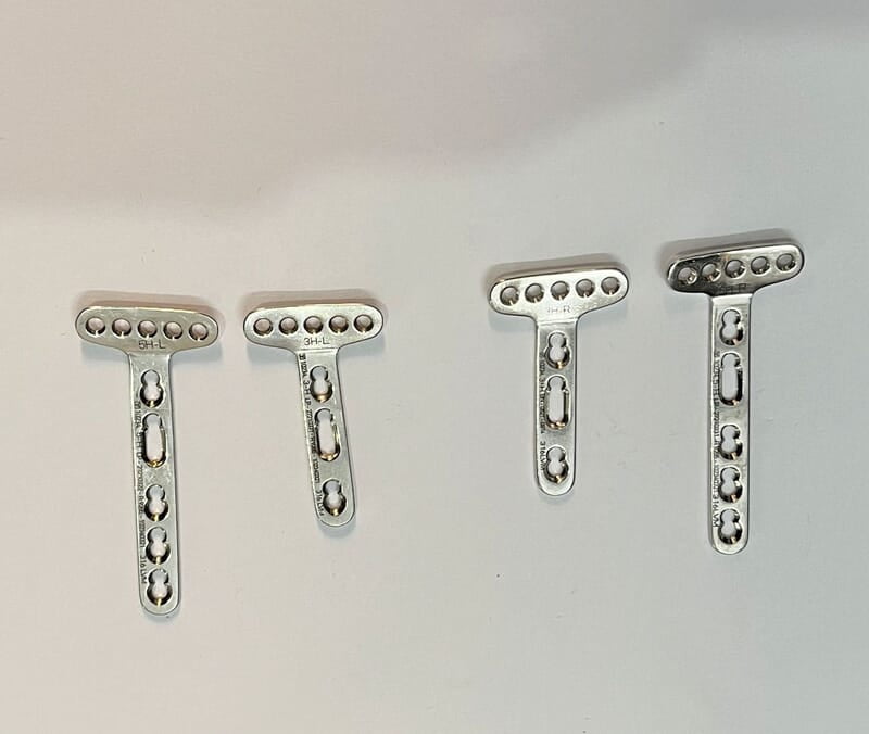 PRIMA LIFT DISTAL RADIUS VOLAR PLATE EXTRA ARTICULAR - 5 HEAD