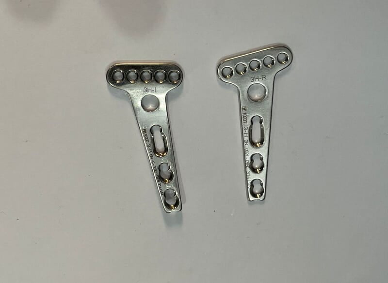 PRIMA LIFT VOLAR BUTTRESS PLATE