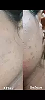 charcoal soap