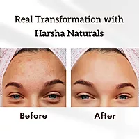 Harsha Naturals - Anti Aging Cream