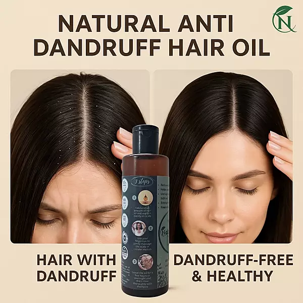 Herbal Anti-Dandruff Hair Oil – The Natural Way to Flake-Free, Healthy Hair