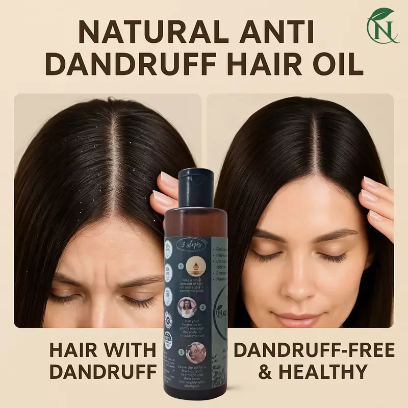 Herbal Anti-Dandruff Hair Oil – The Natural Way to Flake-Free, Healthy Hair