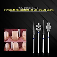 SuperEndo Crown Preparation Bur Kit – Diamond FG Burs for Airotor