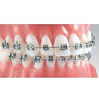 ET Dental MBT 022 Mini Brackets Kit (Non-Extraction)