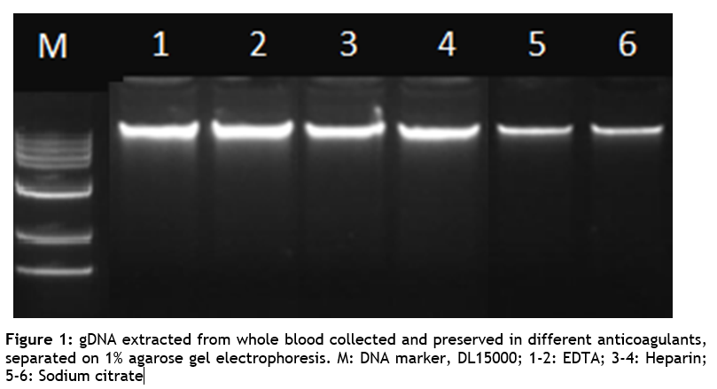 SPINeasy® DNA Kit for Blood 50preps MPBio