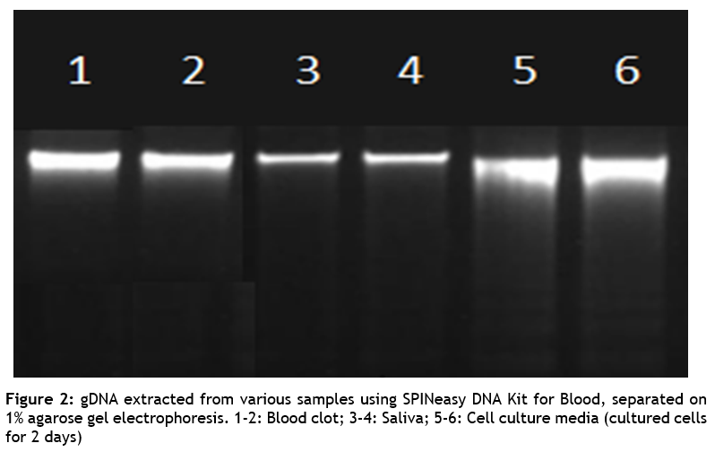 SPINeasy® DNA Kit for Blood 50preps MPBio