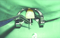 Diadent Paper Points Millimeter Marked 2% Endodontic Paper Points