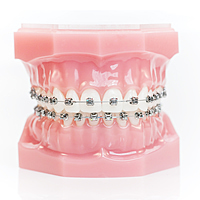 Koden Super Mini MBT Metal Bracket Kits | Mini Orthodontic Brackets for Dental Use