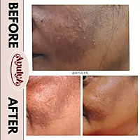 De-Pigmentation Bathing Bar