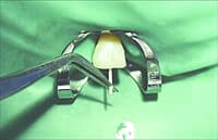 DiaDent Gutta Percha Points for ProTaper