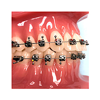 Koden EZ Lock MBT Metal Self-Ligating Bracket Kit with 3 Sets of Cu NiTi Archwires
