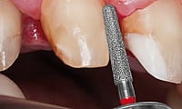 Mani Diamond Airotor Burs CE Series – End Cutting FG Diamond Burs