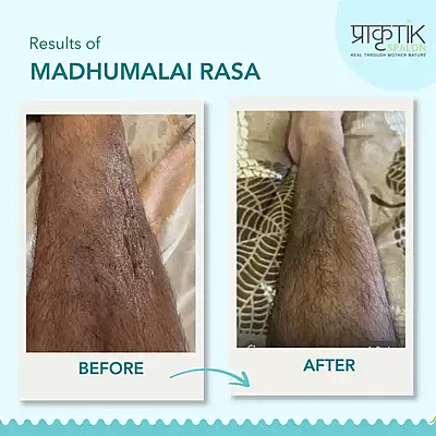 Madhumalai Rasa