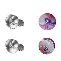 U Ortho Bondable Lingual Buttons Round (10/Pack)