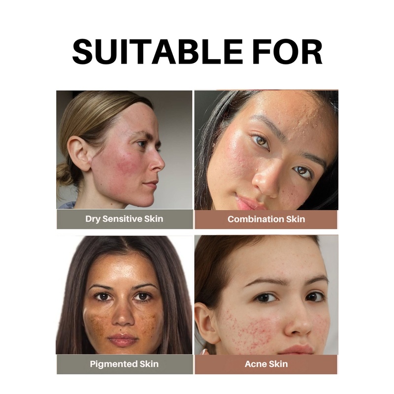 Aurey Korean Rice Face Pack | 50 gm | New