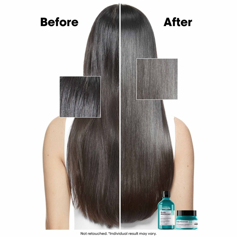 Loreal Scalp Advance Shampoo ANTI- Grass Oiliness