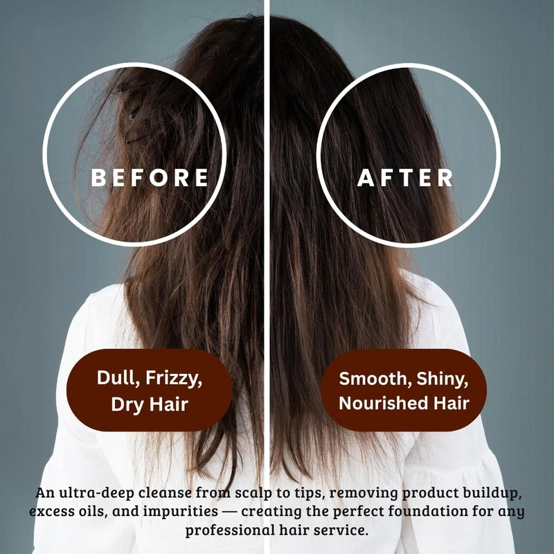 Aurey Clarifying Pro Shampoo With Aloe Vera & D-Panthenol 5000 ml