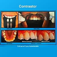 Capri Contrastors Set 3/pk