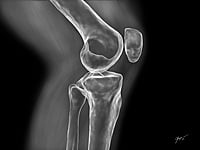 Inkjet medical Canon Ink 500ML Black