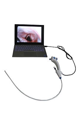 RNB Premium 5.2mm Laptop Compatible Video Bronchoscope without USB Adaptor (DAE3) RNB Premium 5.2mm Laptop Compatible Video Bronchoscope without USB Adaptor (DAE3)