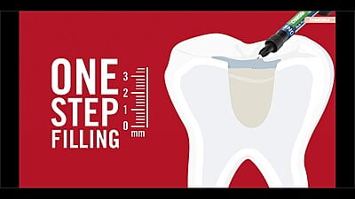 Kulzer Charisma Bulk Flow Syr 1 X 2G Kulzer Charisma Bulk Flow Syr 1 X 2G