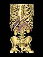 Inkjet Medical WHITE Film 8"X10" DR/CR/MRI/CT Imaging Film 175 Micron / 240 gsm 100 SHEETS Inkjet Medical WHITE Film 8"X10" DR/CR/MRI/CT Imaging Film 175 Micron / 240 gsm 100 SHEETS