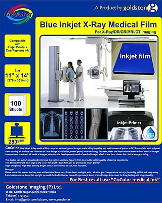 Inkjet Medical Blue Film for X Ray / SIZE 11" x 14" X 100 Sheets Inkjet Medical Blue Film for X Ray / SIZE 11" x 14" X 100 Sheets