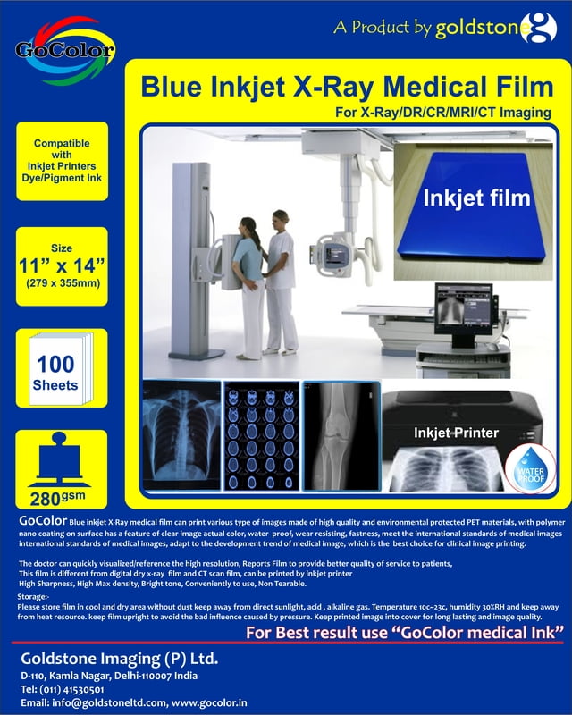 Inkjet Medical Blue Film for X Ray / SIZE 11" x 14" X 100 Sheets Inkjet Medical Blue Film for X Ray / SIZE 11" x 14" X 100 Sheets