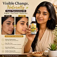 Harsha Naturals - Hyperpigmentation Serum