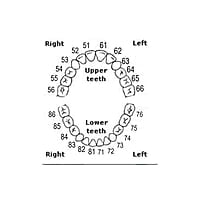API Typodont Teeth Set with Screw