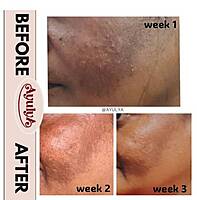 De-Pigmentation Bathing Bar