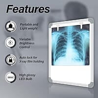 OPG X-Ray Film Viewer LED with Sensor – Dental Radiography Viewer