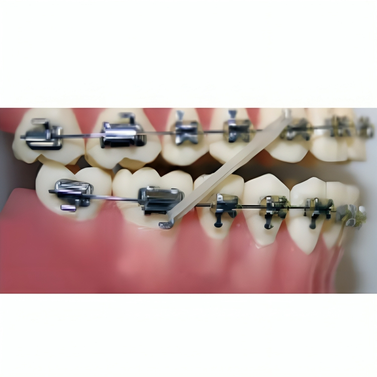U Ortho Bondable Buccal Tubes – 1st Molar MBT 0.022 – U1/L1