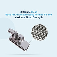 U Ortho Lingual Brackets 018 – STB, Silver & Golden Series